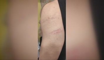 Tínedžer spod Tatier prišiel z mikulášskej akcie s modrinami. Palicou ho mal dobiť čert