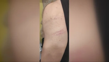 Tínedžer spod Tatier prišiel z mikulášskej akcie s modrinami. Palicou ho mal dobiť čert