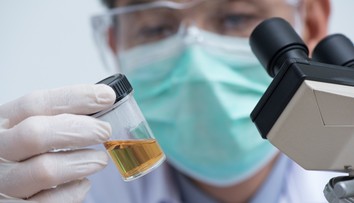 Žena má v moči veľké množstvo alkoholu napriek tomu, že vôbec nepije