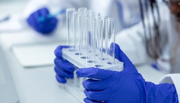 Objavil sa smrteľný vírus, prenášajú ho malé zvieratá. Nemecko hlási už tri obete