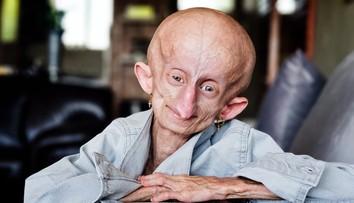 Stala sa hlasom ľudí so vzácnou genetickou poruchou. Hviezda TikToku zomrela vo veku 19 rokov