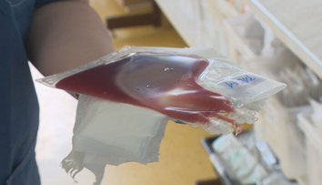 Stále viac matiek tvrdí, že ich tlačili do darovania pupočníkovej krvi. Niektoré pôrodnice darcovské odbery stopli