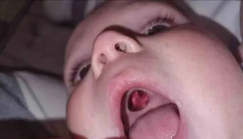Ženu vystrašila diera v ústach bábätka. Keď sestrička zistila, o čo ide, smiech sa im nezastavil
