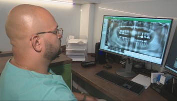 Zmluvní zubári si pýtajú peniaze za röntgen. Zdravotné poisťovne tvrdia, že ho plne hradia