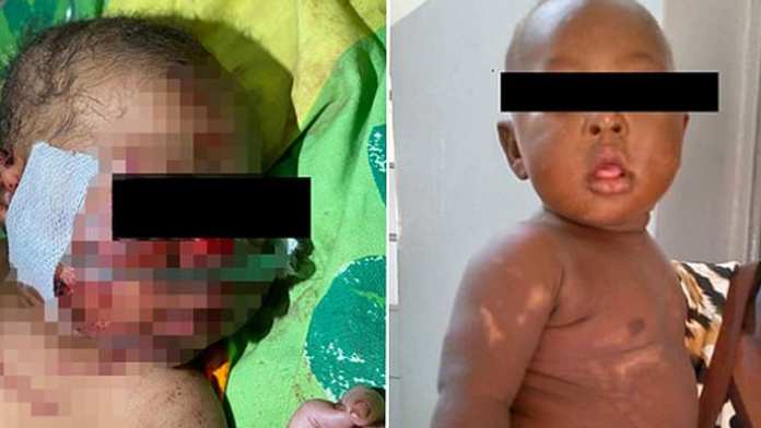 Hrôza, ktorá sa skončila zázrakom. Matka zakopala novonarodené dievčatko, napokon ho zachránili príbuzní