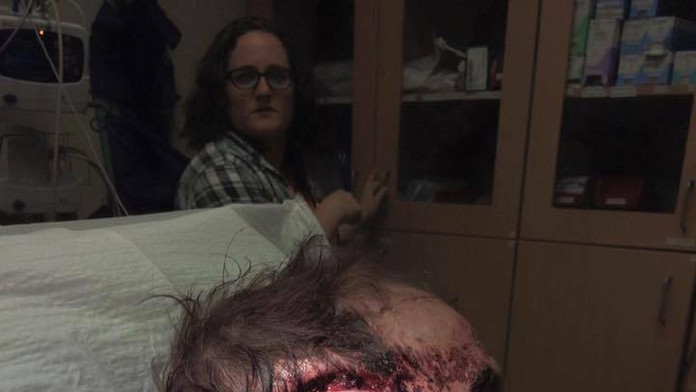 Zostane mu strašná jazva.