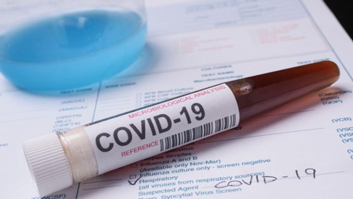 Svetom sa šíri nový variant covidu. Ak máte „žiletkovú“ bolesť v krku, mali by ste spozornieť