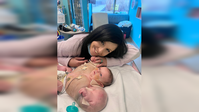 Nedávali jej žiadnu šancu na prežitie. Dievčatko trpiace vzácnou vrodenou poruchou prirovnávajú k superhrdinovi