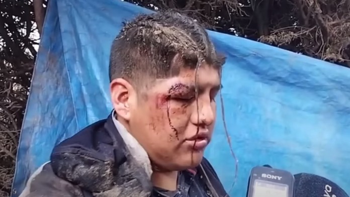 Hororový zážitok z festivalu. Muž sa po prehýrenej noci zobudil v rakve