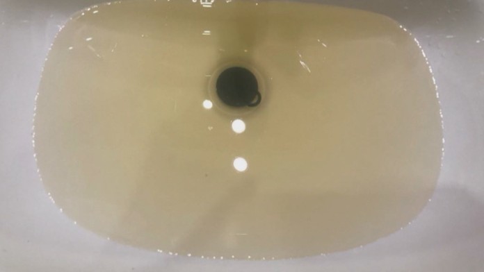 Opozícia tvrdí, že obrovský biznis za stovky miliónov eur je ušitý na mieru jednej firme.