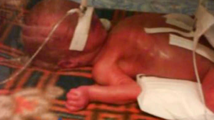 Alex sa narodil predčasne a vážil necelé kilo. Takto vyzerá malý bojovník dnes