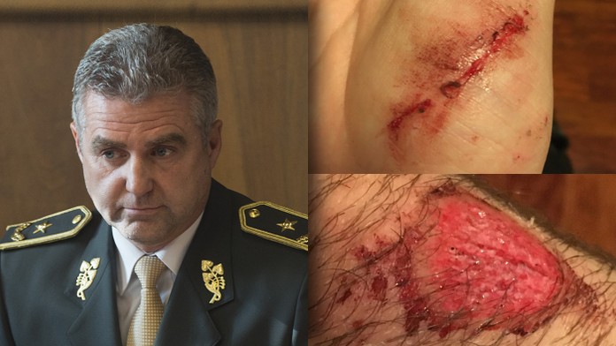 Policajný prezident Tibor Gašpar a zranenia 16-ročného chlapca (koláž)