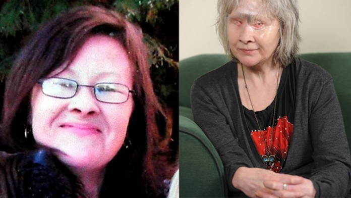 Wendy Hamridingovej zjedol pes tvár