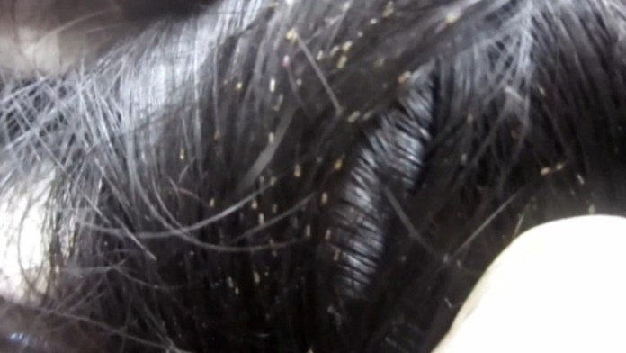 Problém sa vraj vyskytuje už dlhšie. Nikto ho však nerieši