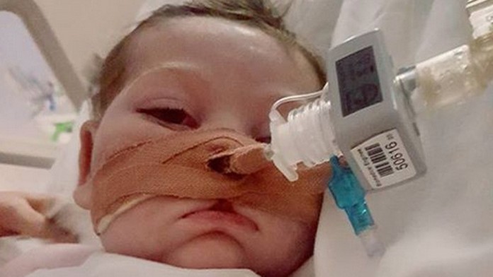 Malý Charlie trpí vzácnou genetickou poruchou a má poškodený mozog. 