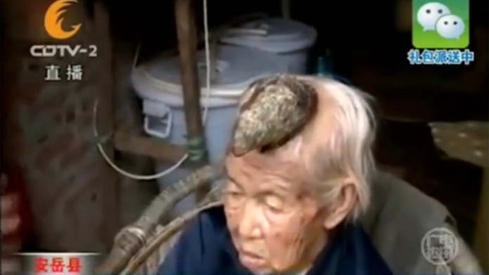 Starenke narástol na hlave roh.