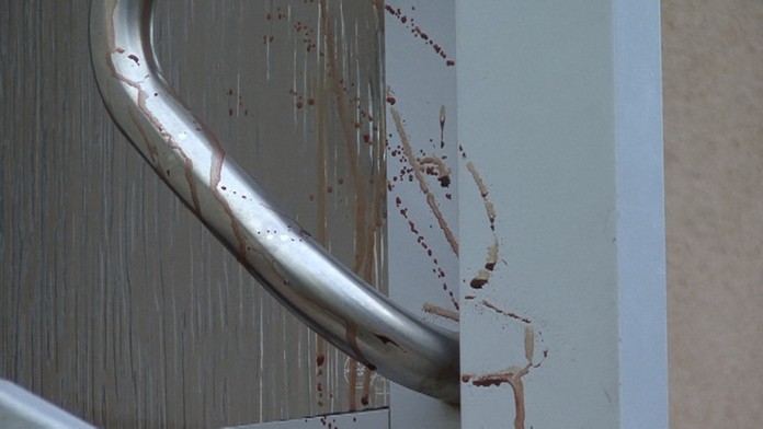 nemocnica_tvnoviny.mp4