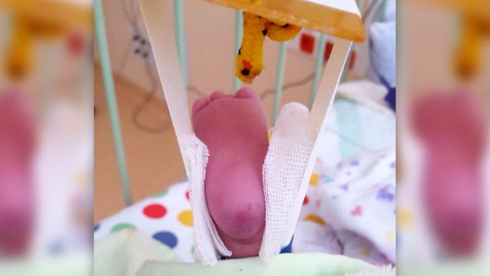 Záhadná zlomenina.