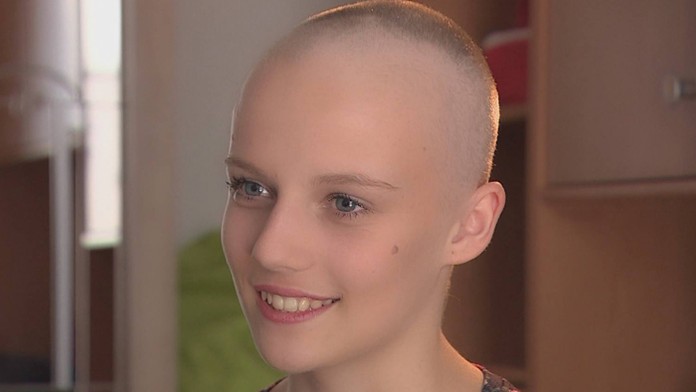 Sofi napriek chorobe rozdáva úsmev.