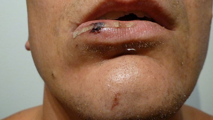 Policajná brutalita