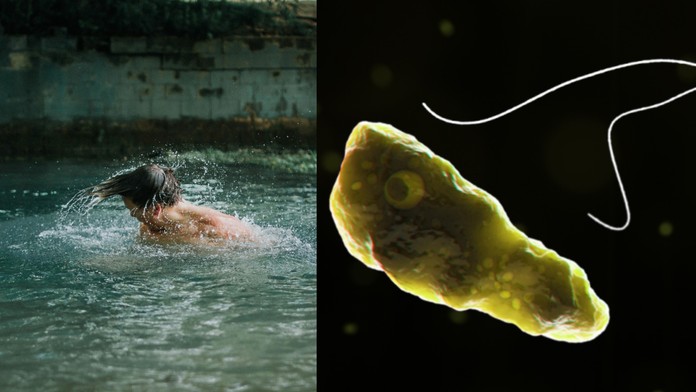 Lekárka tvrdí, že nie je dôvod na obavy z kúpania. Smrtiaca améba chlórovanie neprežije, no nakaziť sa dá aj inak