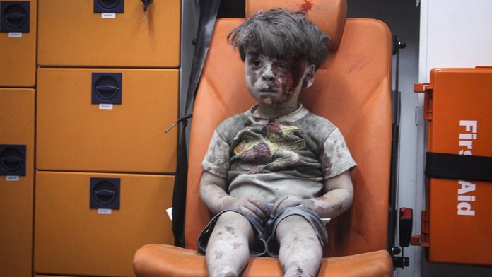 Omran Daqneesh