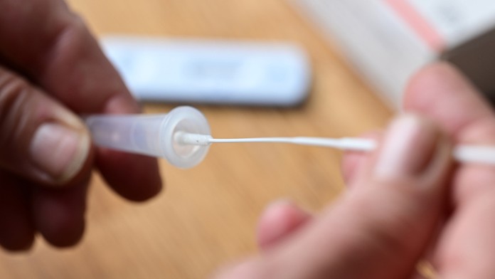 Testovanie domácim antigénovým samotestom na ochorenie Covid-19.