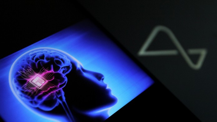 Čip v mozgu - ilustračná snímka