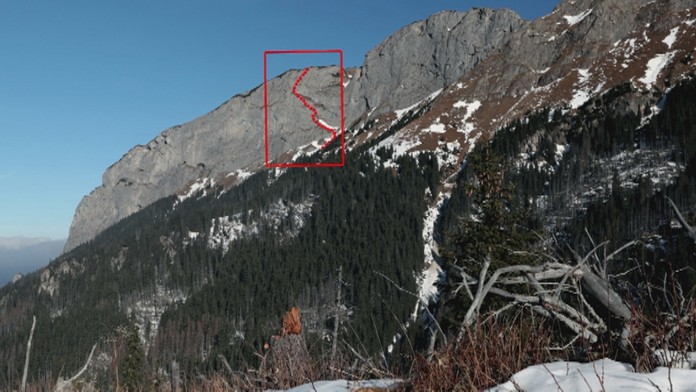 Rozdelenie siamských dvojčat. 