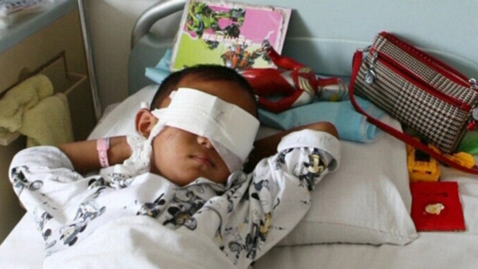 Iba 6-ročnému chlapcovi vylúpli oči