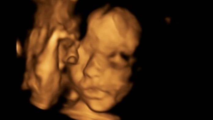 Futbalista Wolverhamptonu Wanderers Matt Doherty (uprostred) a brankár Newcastle United Martin Dúbravka.