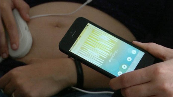 Monitor a mobilná aplikácie pre tehotné ženy
