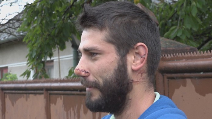 Atillu z Marcelovej napadol mladší brat David mačetou. 