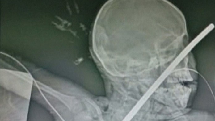 1911_Zabijak_19_11_P30_Ne_20_15.mp4