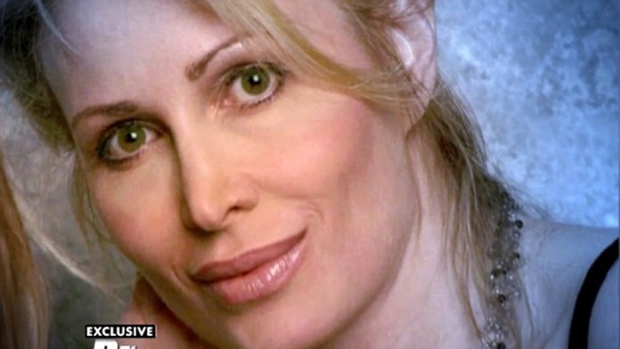 Z krásky sa stal netvor! Žena po nepodarenej plastike takmer spáchala samovraždu