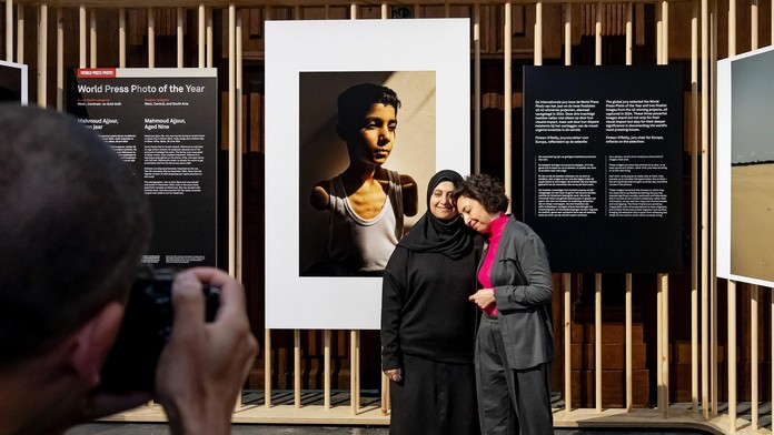 Ako ťa teraz budem môcť objať? Súťaž World Press Photo ovládla snímka palestínskeho chlapca, ktorý prišiel o ruky