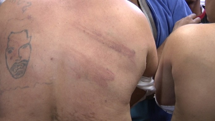 Rómov údajne brutálne zbili policajti