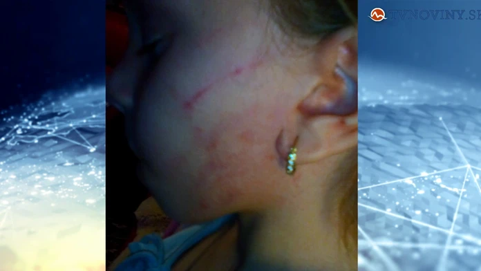 zubarka.jpg