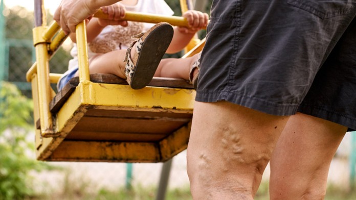 Ilustračná snímka.