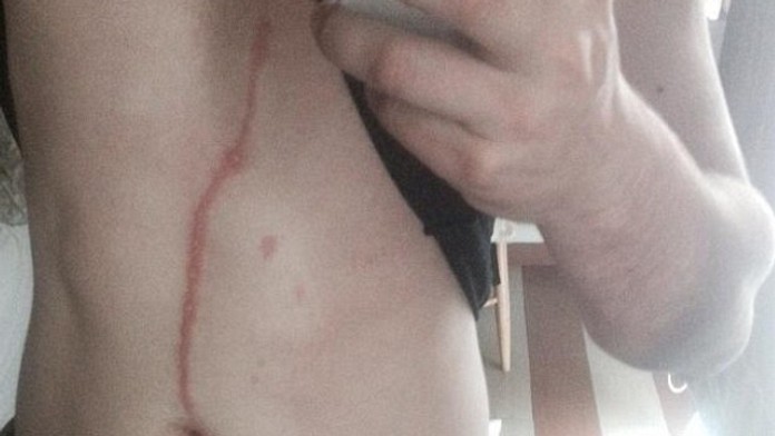 Dylan Thomas mal v bruchu pavúka. 