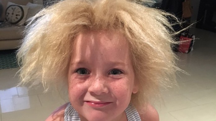 Rozkošné dievčatko má vlasy ako Albert Einstein.