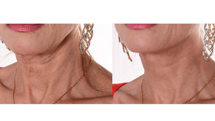 Výsledok je očividný.