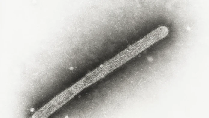 Na snímke z elektrónového mikroskopu z roku 2005 vírus vtáčej chrípky A/H5N1. 