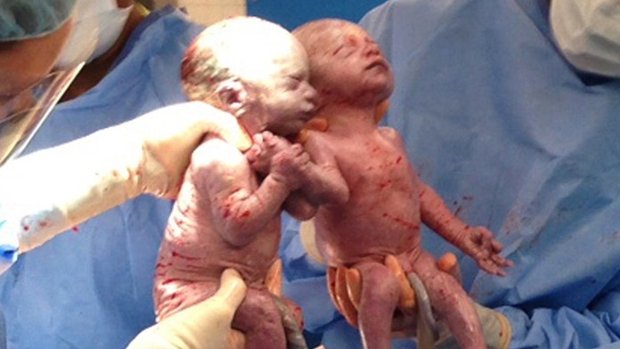 dvojičky Jenna a Jillian