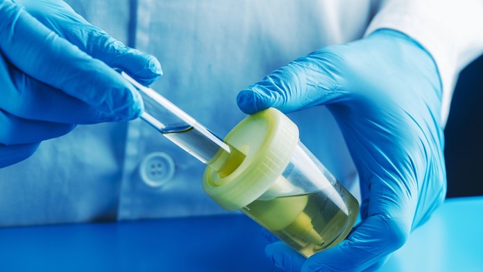 Mladík sa zmieril so smrťou a kúpil si hrob. Ukázalo sa, že lekár si diagnózu vymyslel