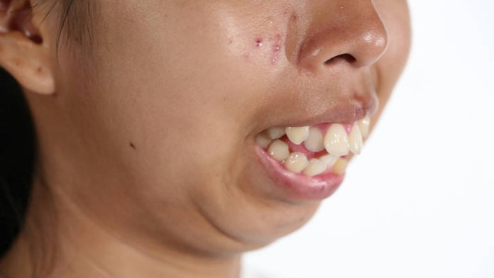 Úžasná premena tínedžerky. Teraz je z nej neskutočná krásavica