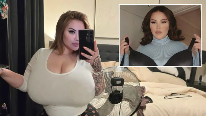 Austrálčanka trpí vzácnou poruchou. Prsia jej začali nekontrolovateľne rásť, keď mala 25 rokov