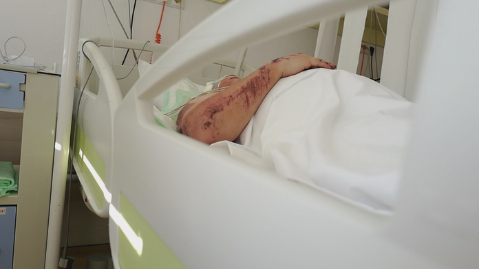 Český turista vypadol z okna v Tatrách