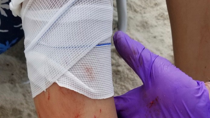 Zranená Lola Pollinová.