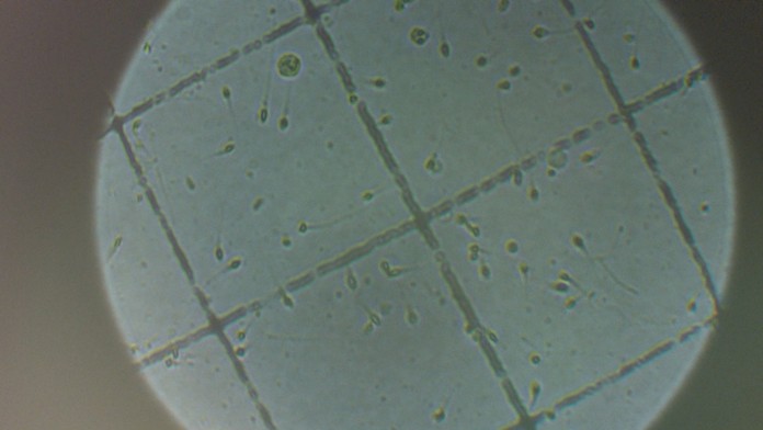 1_onruskova_opoj_pokr_tvnoviny.mp4